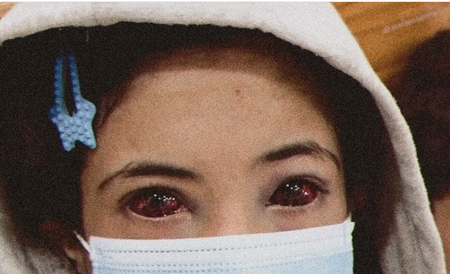 image of 13 year old Amina, her eyes are fully red and covered in blood, her nose and mouth are covered by a facemask. She wears a beige hoodie